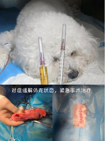 产后子宫破裂、腹膜炎，脓腹